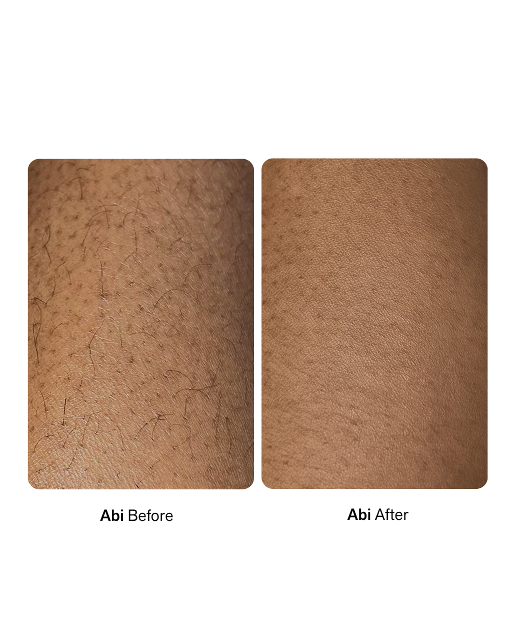 NIMBI Body Sculpt bio-cartridge refill