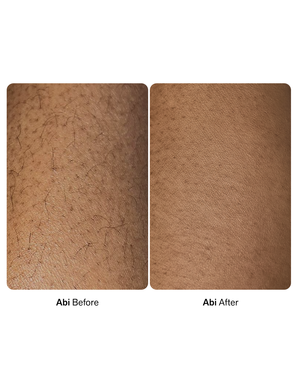 NIMBI Shave Duo