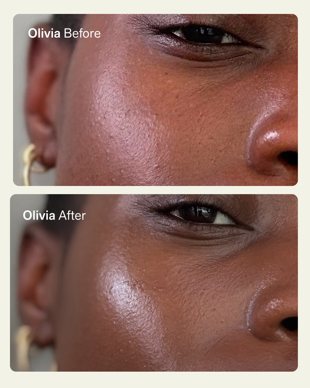 NIMBI Pillow Slip Dermaplaner Oil