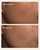 NIMBI Pillow Slip Dermaplaner Oil