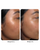 NIMBI Skin Renewal Dermaplaning Duo