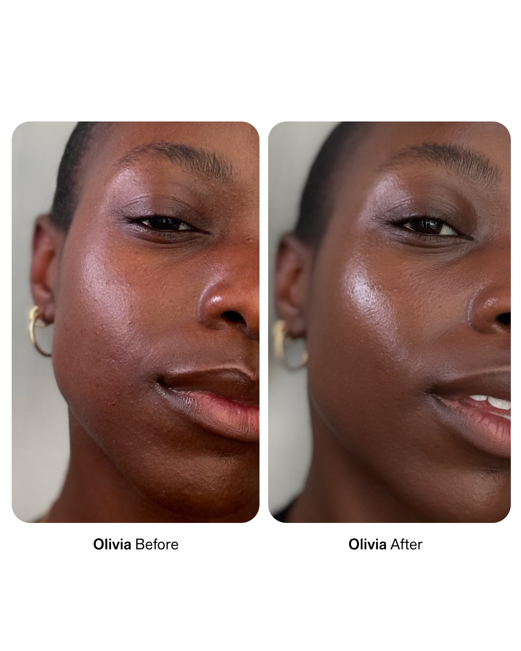 NIMBI Skin Renewal Dermaplaning Duo