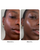 NIMBI Skin Renewal Dermaplaning Duo
