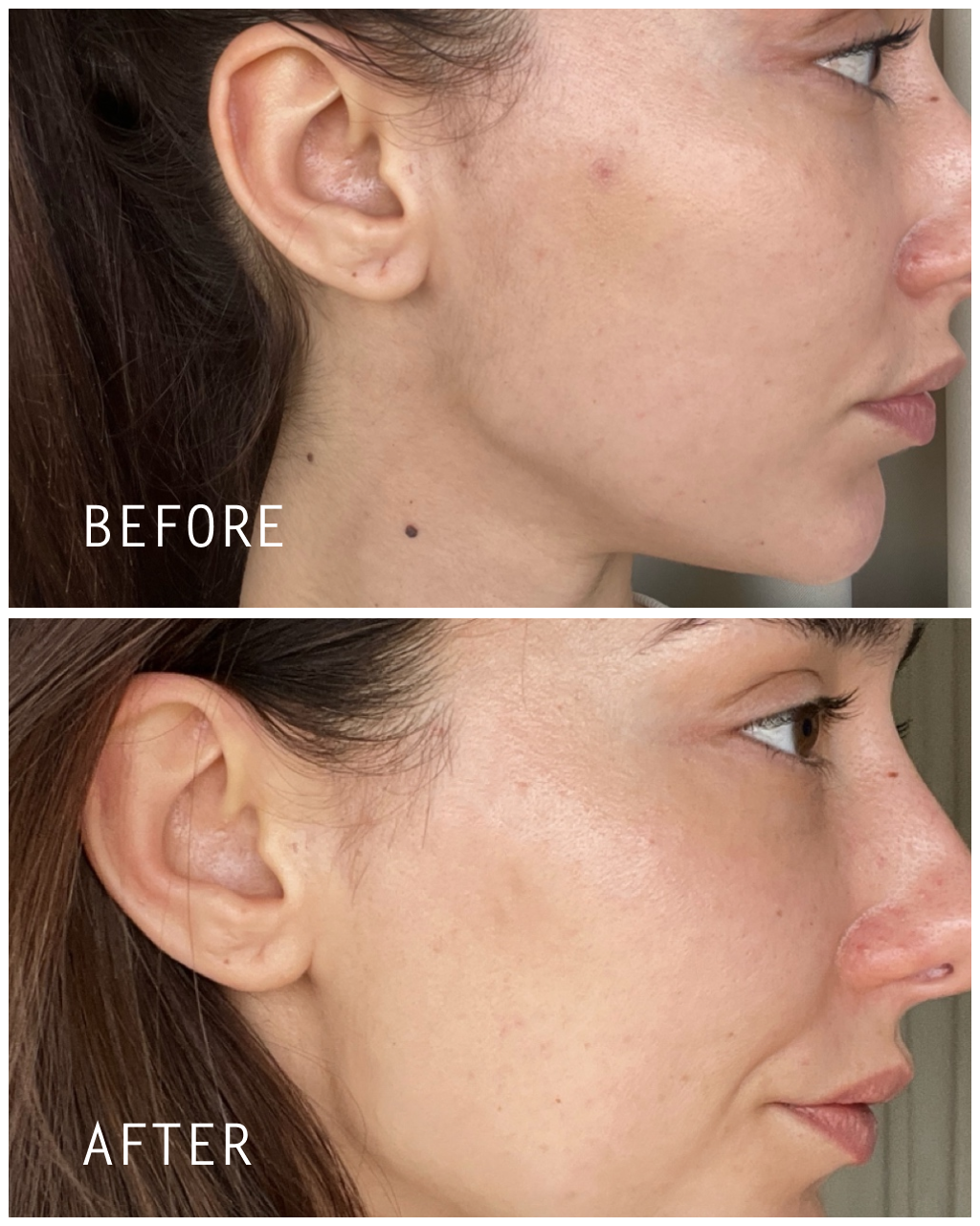 NIMBI Facial Dermaplaners